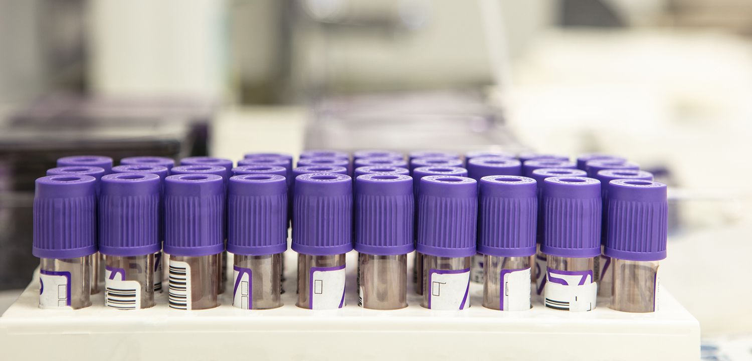 PFAS, Environmental Contamination, and Health